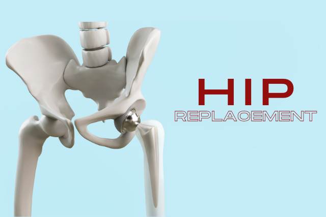 total knee replacement bone and joint consult