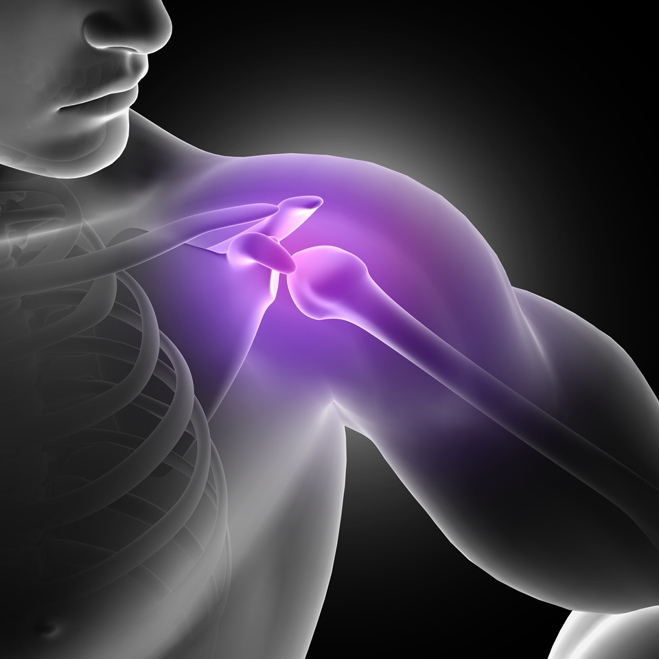 Arthroscopic Bankart repair for shoulder instability