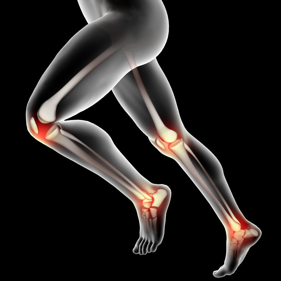 High Tibial Osteotomy Surgery